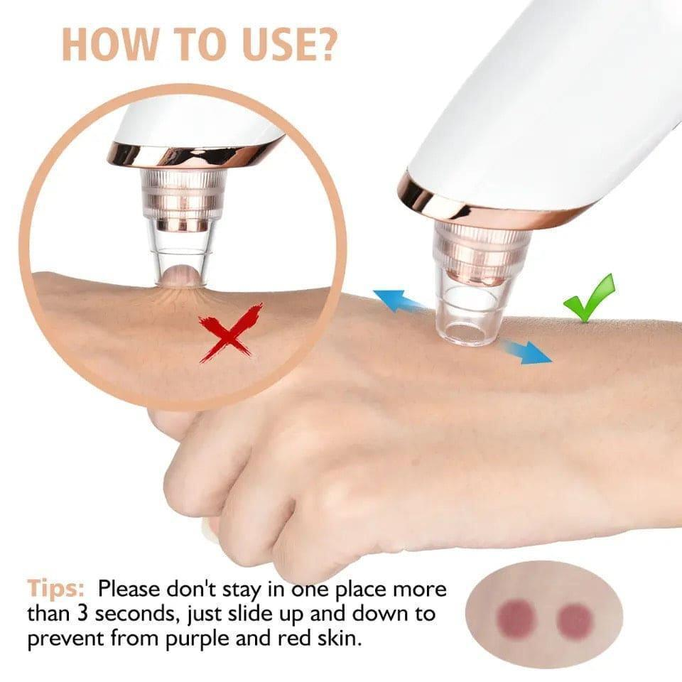Blackhead Remover Nose Pore Cleaner